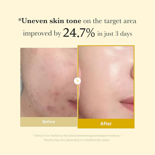 Before and after comparison of skin tone improvement with text indicating 24.7% improvement in 3 days.