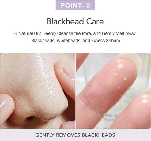 Blackhead Removal Oil UAE

Jojoba Cleansing Oil UAE

Facial Oil Cleanser UAE

Deep Pore Cleanser UAE

Skincare Products UAE

Oil Control Facial Cleanser

Clear Smooth Skin Serum UAE

Gentle Cleanser for All Skin Types

سيروم تنظيف البشرة بزيت الجوجوبا

إزالة الرؤوس السوداء